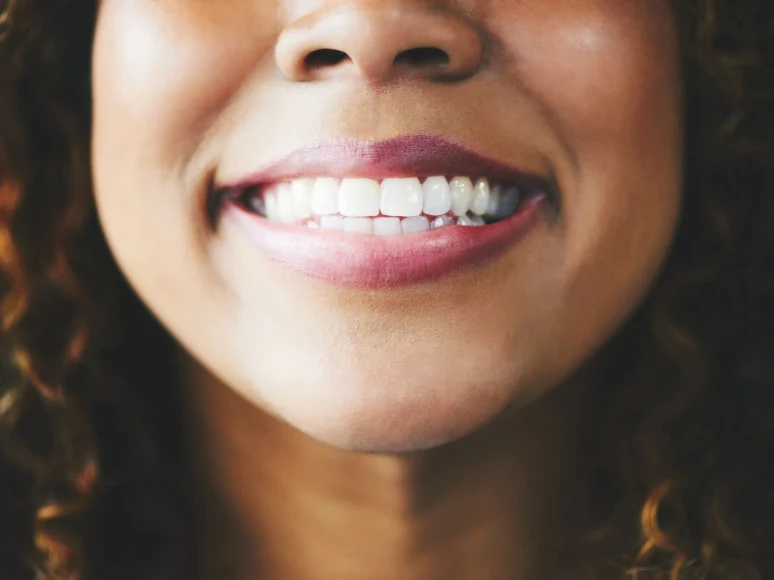 Close-up of a patient's healthy, evenly aligned smile