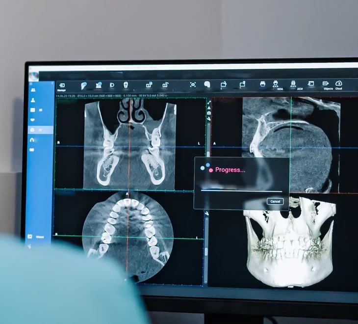 Dental scans displayed across a diagnostic monitor