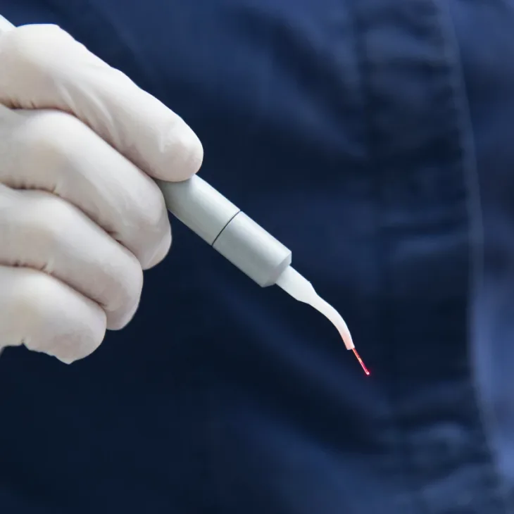 A gloved hand holding an ultrasonic scaler tip